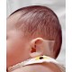 چسب اصلاح فرم گوش نوزاد alke