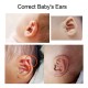 چسب اصلاح فرم گوش نوزاد 4 در 100سانت alke