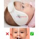 هد بند اصلاح فرم گوش نوزاد و کودک